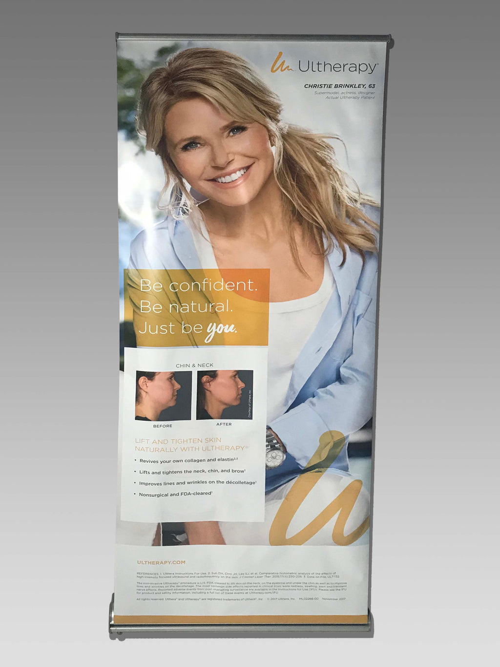 Ultherapy Skin Tightening Chin And Neck Christie Brinkley Vinyl Banner 31" x 80"