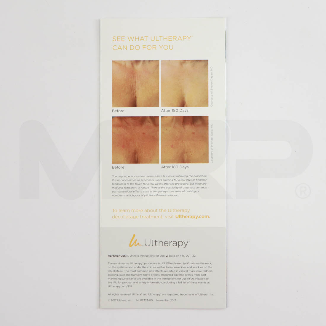 Ultherapy Ultrasound Treatment Marketing Brochure - Décolletage Campaign (10 Pack)
