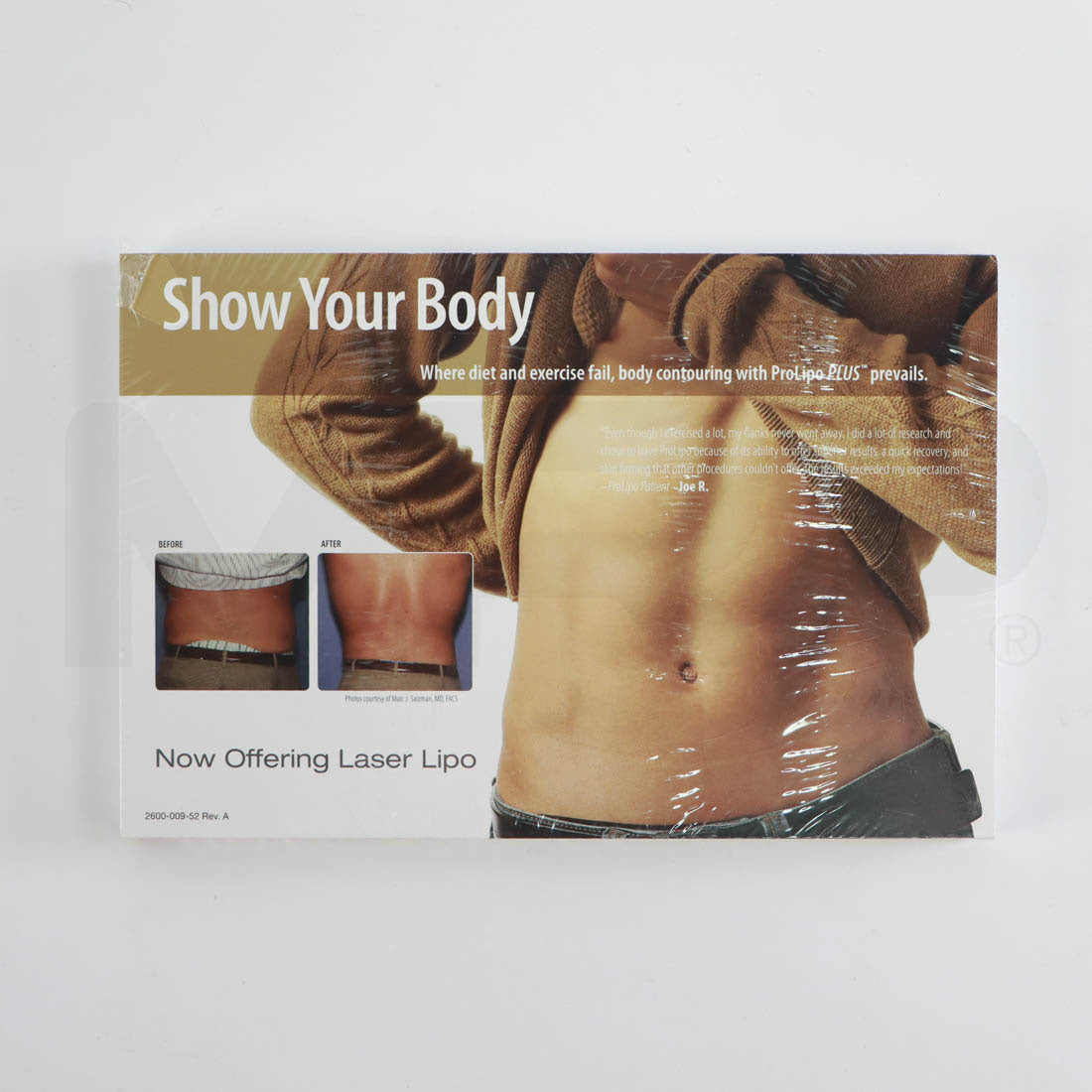 Sciton ProLipo Plus Show Your Body Marketing Cards (50 Pack)
