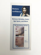 Zarin MCL31 Erbium Laser Skin Rejuvenation Resurfacing Patient Brochures 25 pack