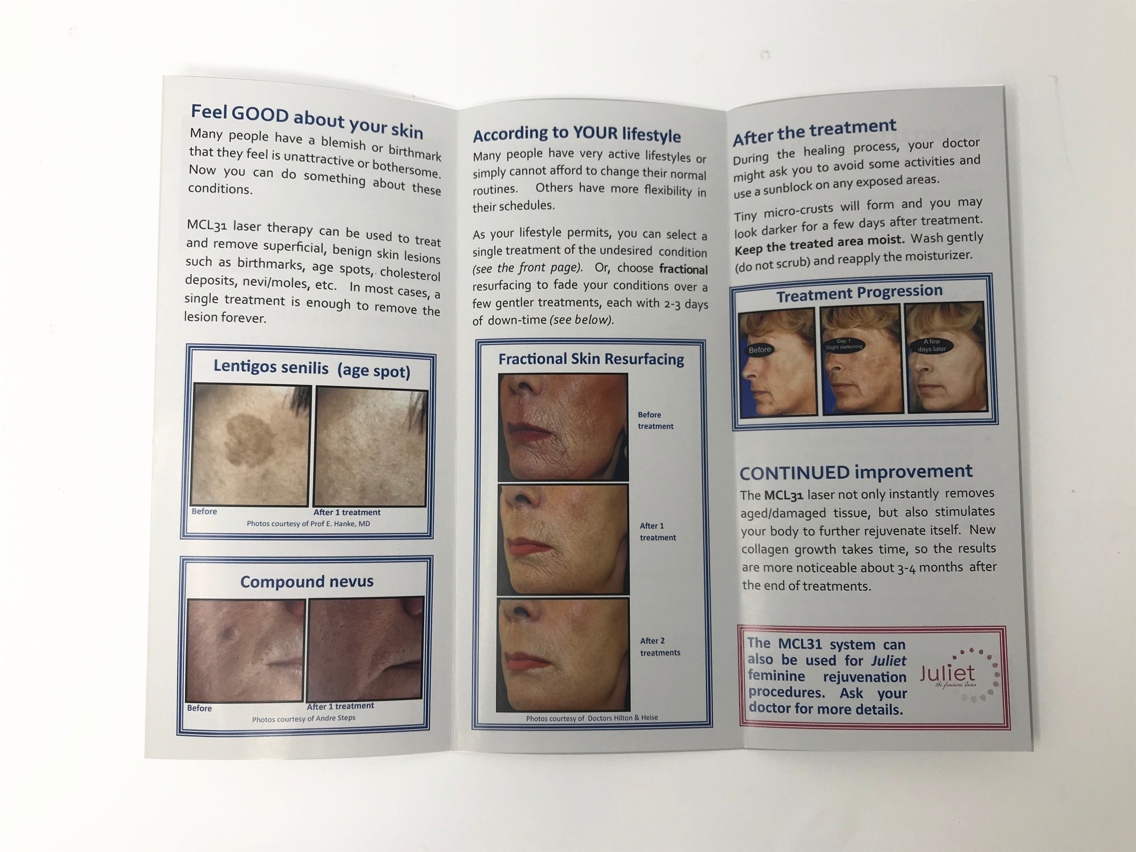 Zarin MCL31 Erbium Laser Skin Rejuvenation Resurfacing Patient Brochures 25 pack