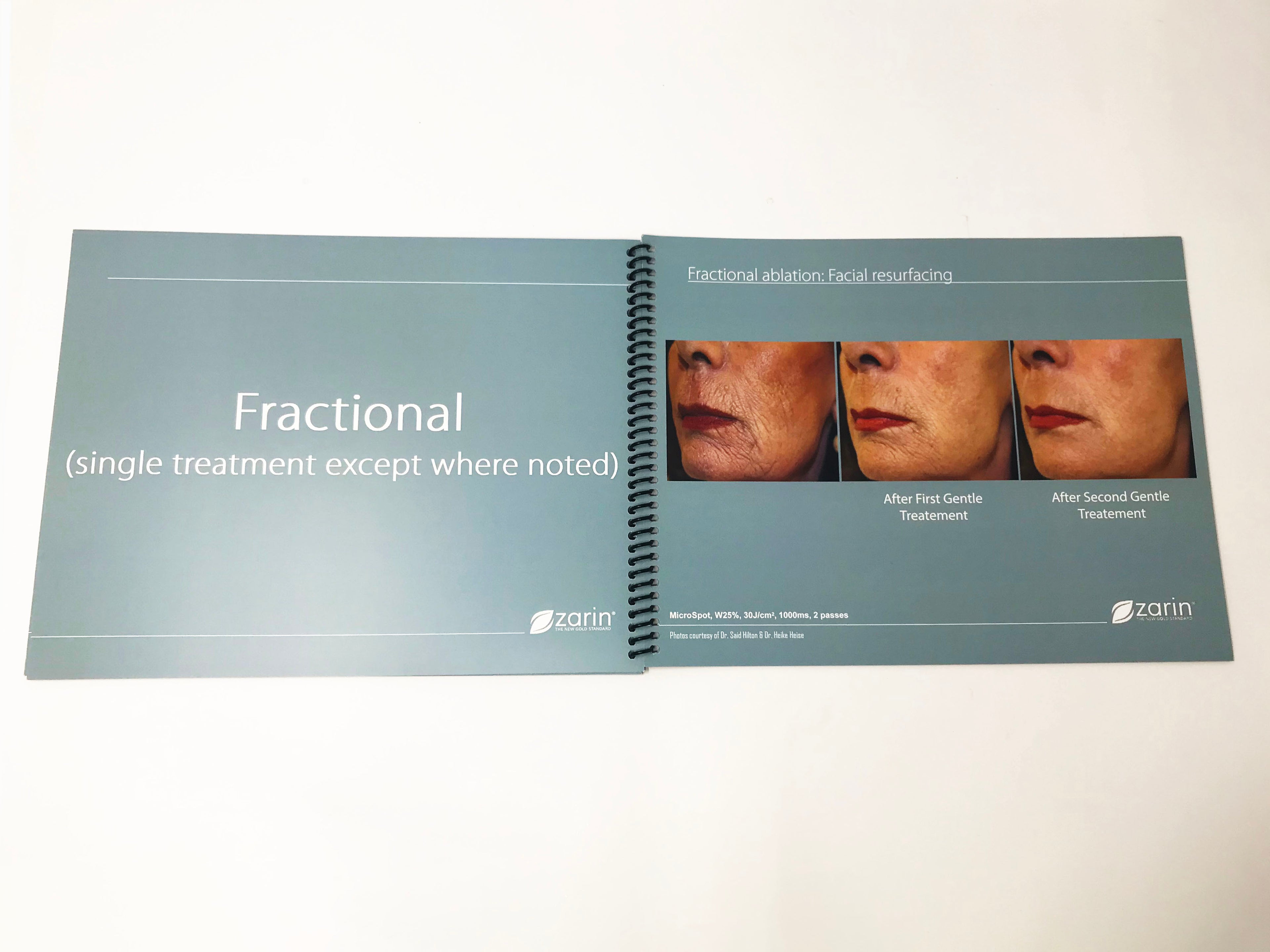 Zarin MCL31 Erbium YAG Laser Ablation Fractional Resurfacing Clinical Case Book