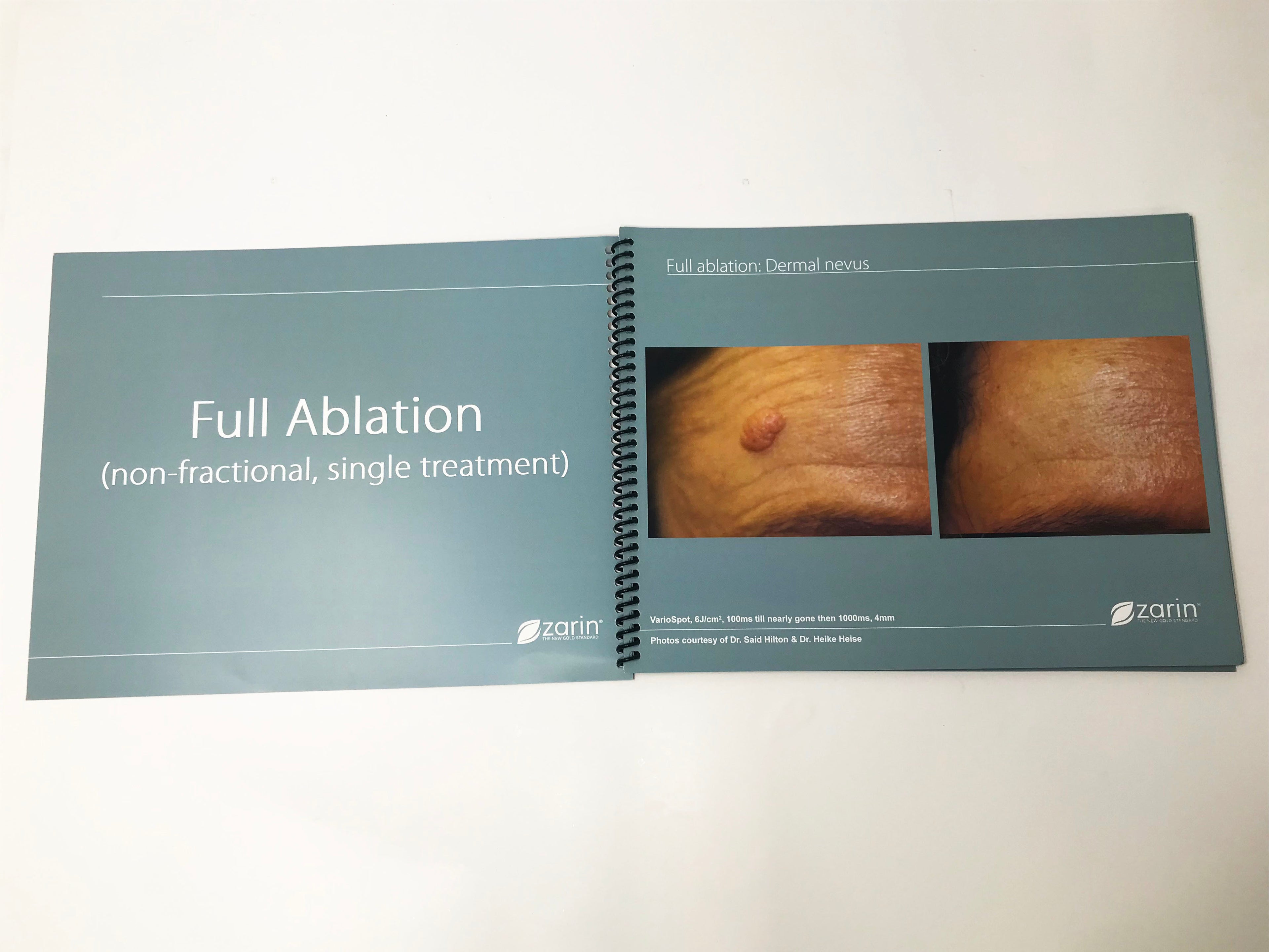 Zarin MCL31 Erbium YAG Laser Ablation Fractional Resurfacing Clinical Case Book