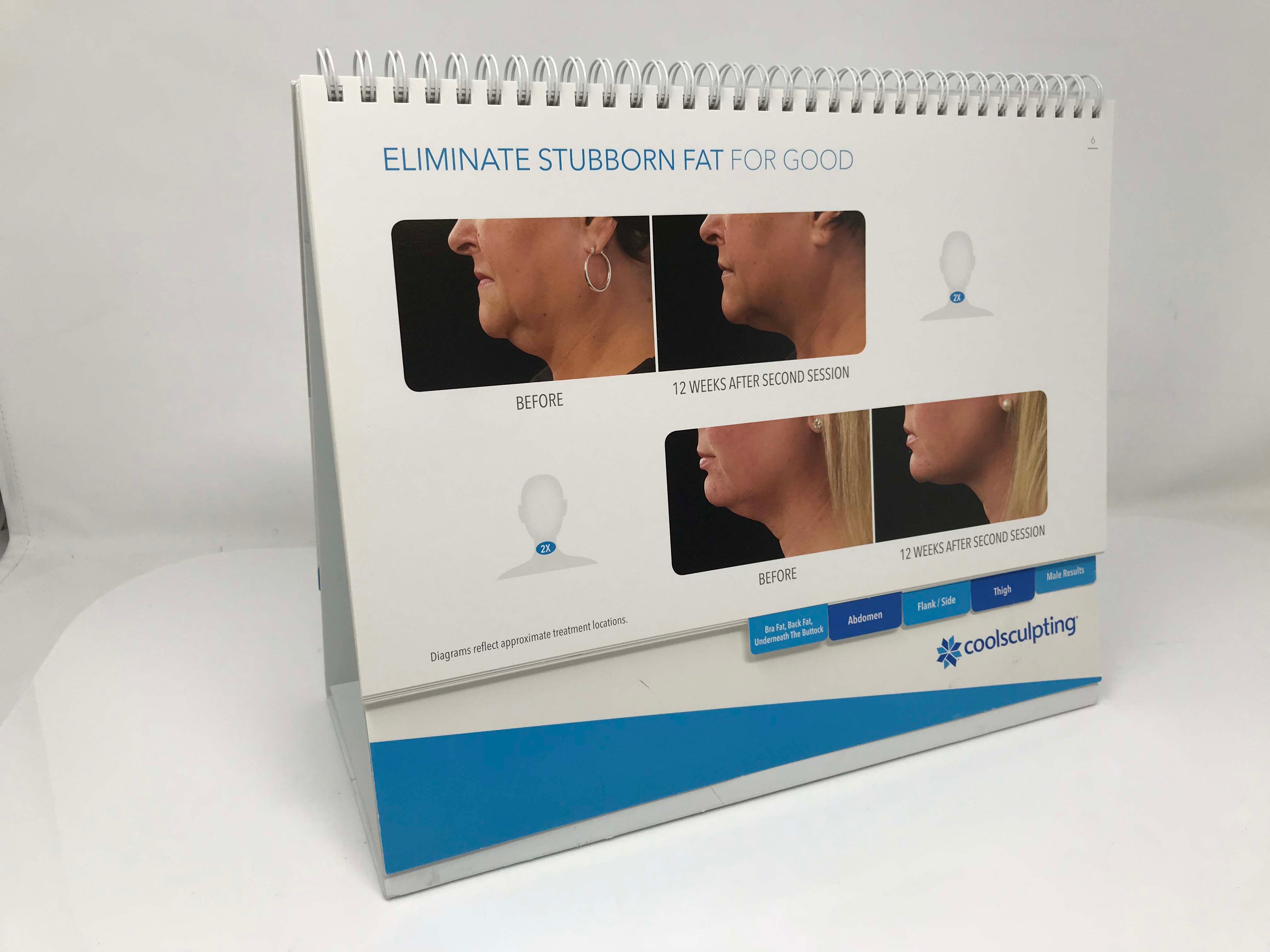 Zeltiq Cool Sculpting Before and After Photo Marketing Patient Results Book
