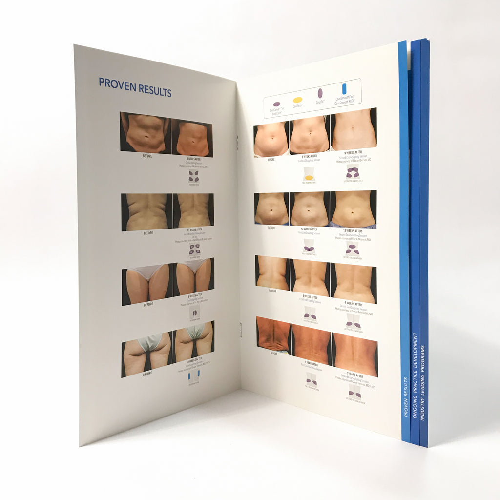 Zeltiq CoolSculpting Fat Reduction Promotional / Marketing Brochure Booklet (X3)