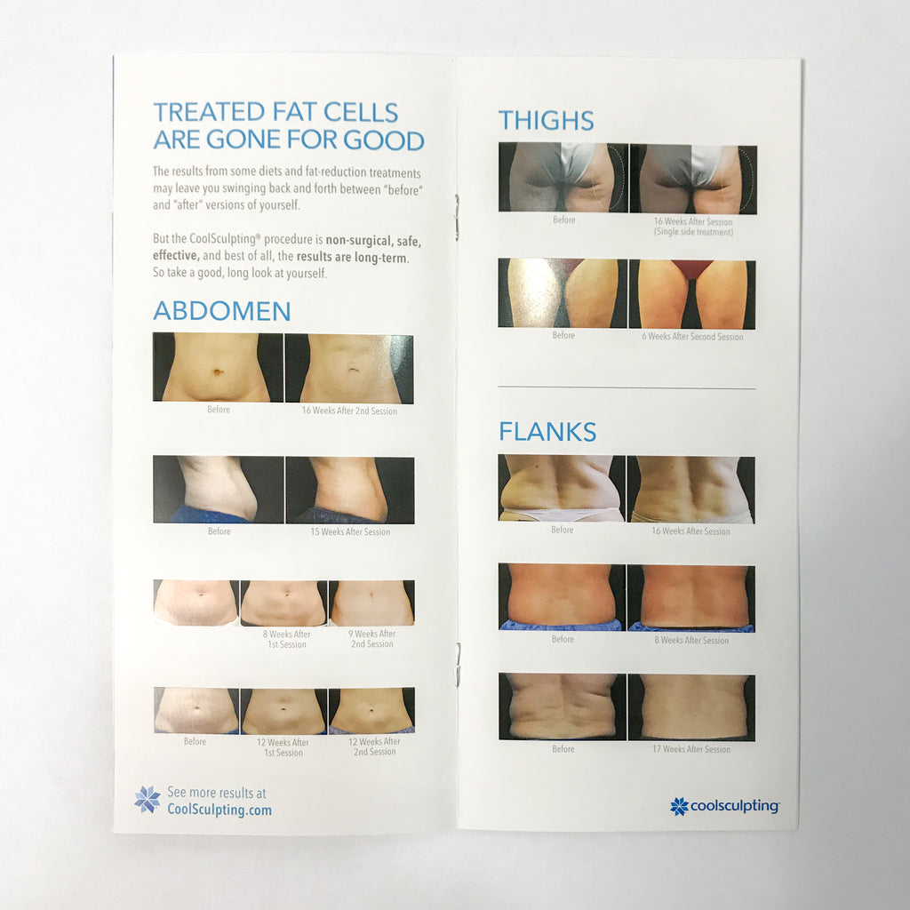 Zeltiq CoolSculpting FREEZE AWAY FAT Booklet Patient Brochure Before After x25