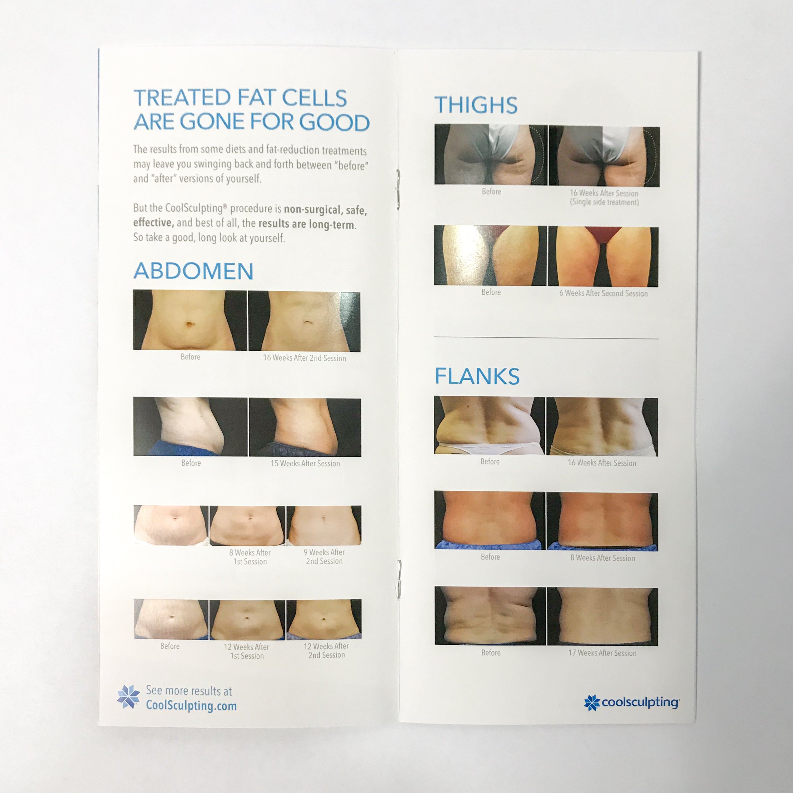 Zeltiq CoolSculpting FREEZE AWAY FAT Booklet Patient Brochure Before After x25