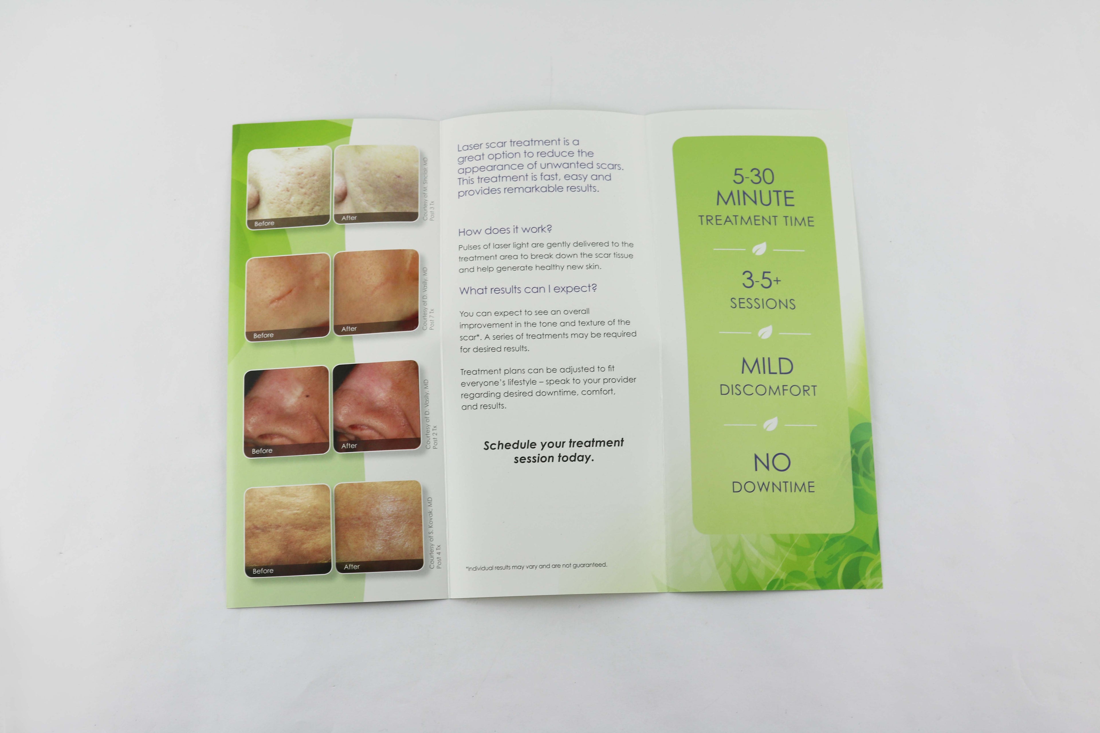 Cynosure ICON Feel Confident In Skin Laser Scar Removal Patient Brochures 94pk