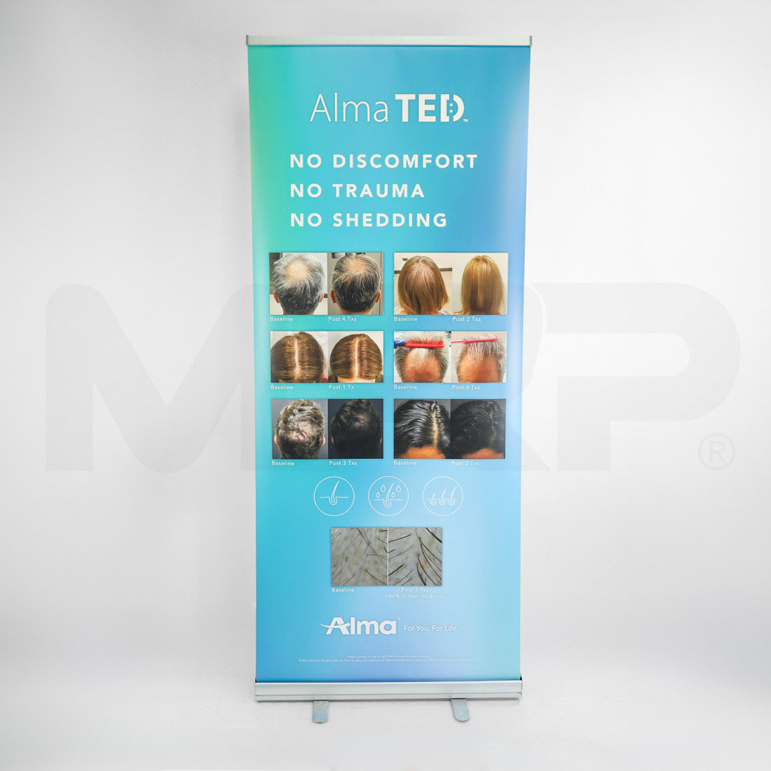 Alma TED Marketing Banner Display