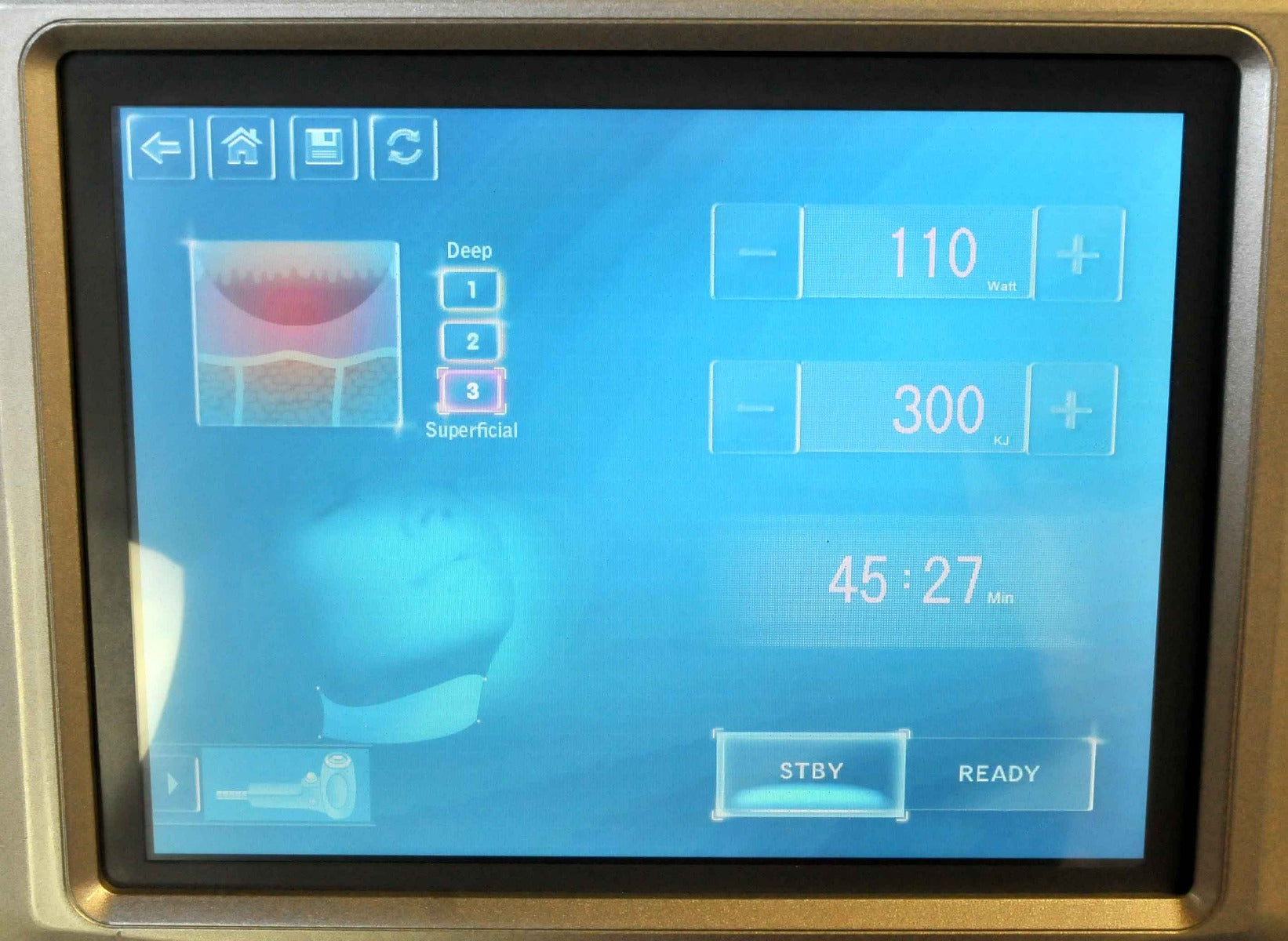 Alma Accent V Shape II 2 RF Ultrasound Body Contouring Acne Scars Wrinkles 2 HP