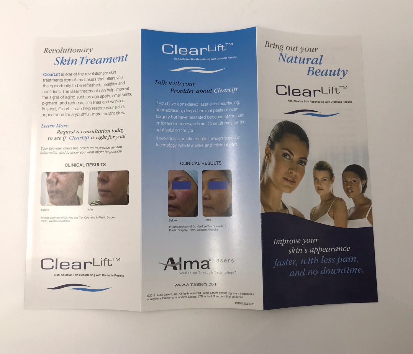 Alma Clear Lift Laser Skin Wrinkle Anti Aging 1064nm Q Switch Treatment Brochure