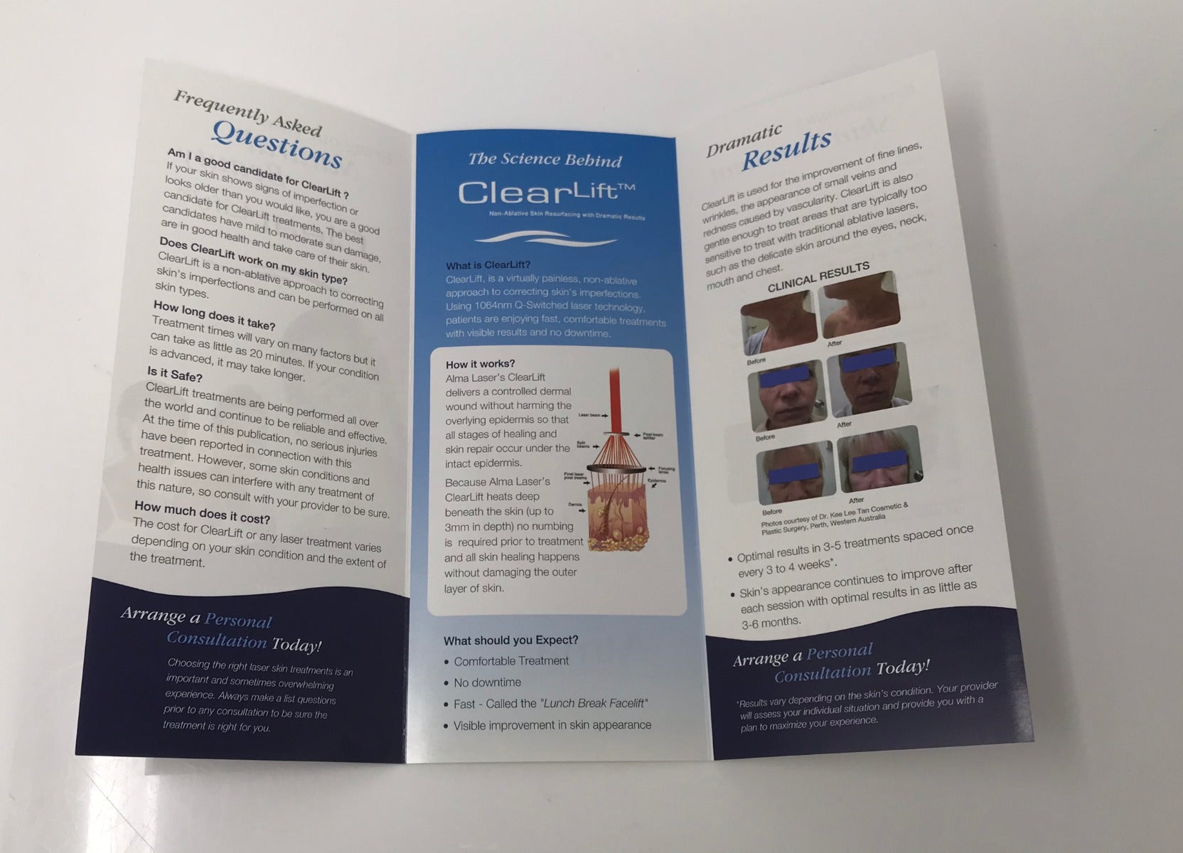 Alma Clear Lift Laser Skin Wrinkle Anti Aging 1064nm Q Switch Treatment Brochure