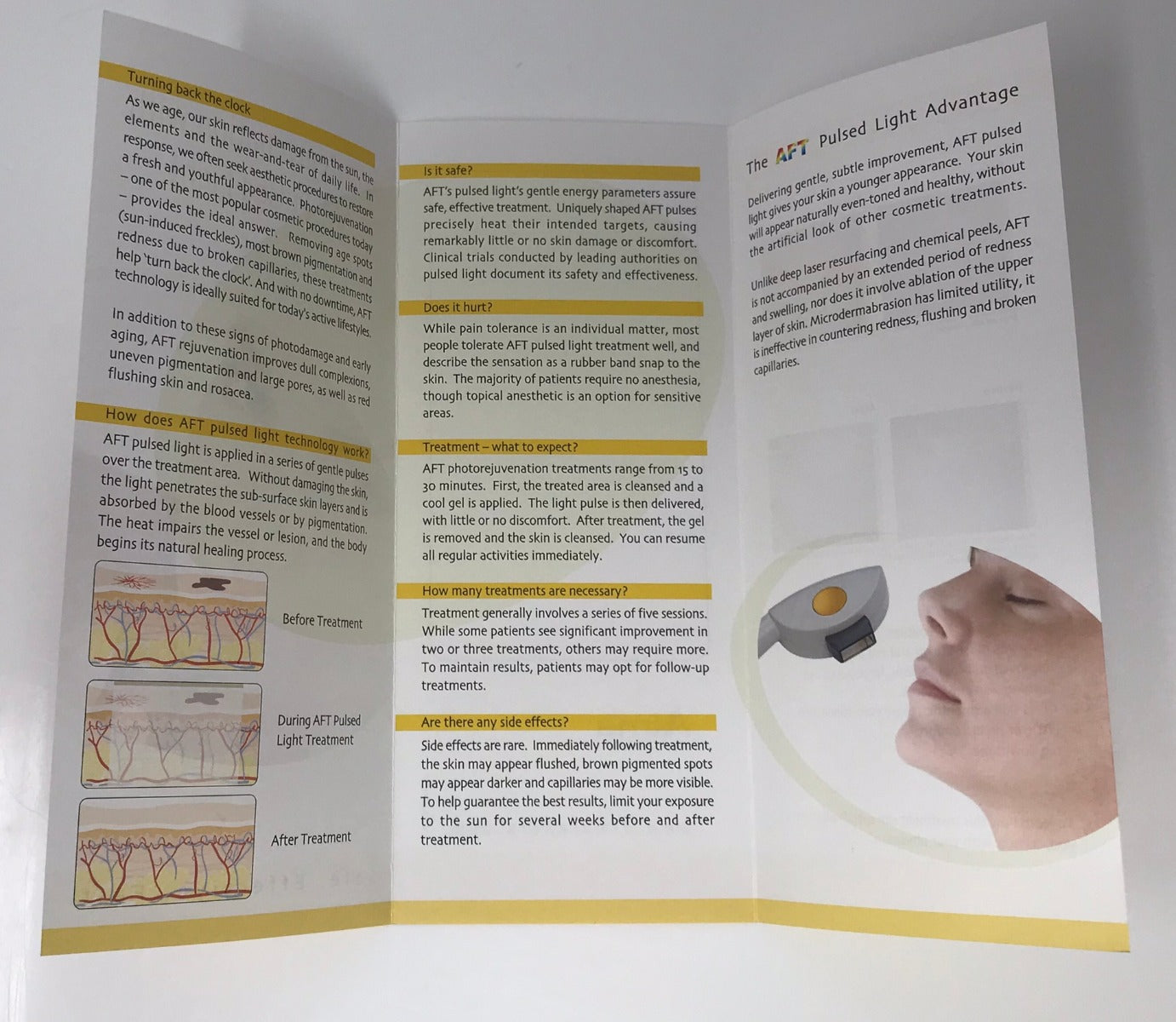 Alma Lasers AFT Pulsed Light Skin Rejuvenation Treatment Patient Brochure 50pcs