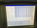 2007 Candela ALEX TriVantage Q-Switched Nd:YAG Tattoo Laser Removal System