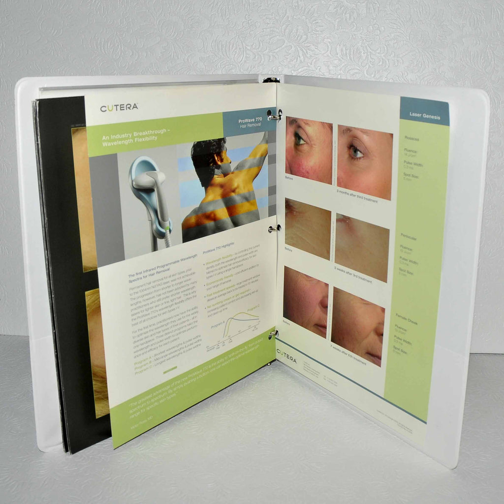 Cutera Xeo Laser Before After Office Photo Patient Treatment Book Consult Guide