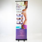 2017 Cutera truSculpt 3D 24x80" Before & After Retractable Display Banner