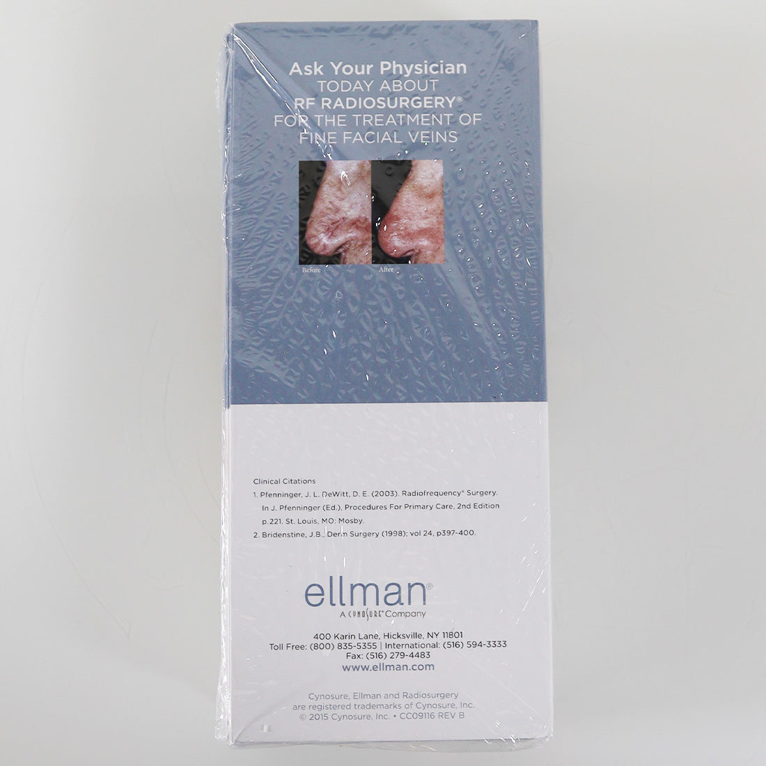 Cynosure Ellman RF Radiosurgery Marketing Brochure Unsightly Facial Veins x50 Pc