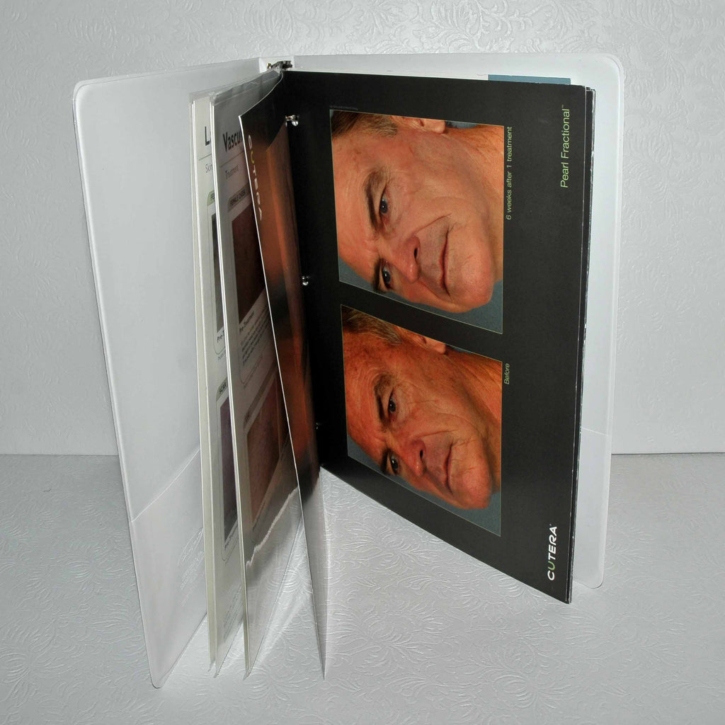 Cutera Xeo Laser Before After Office Photo Patient Treatment Book Consult Guide