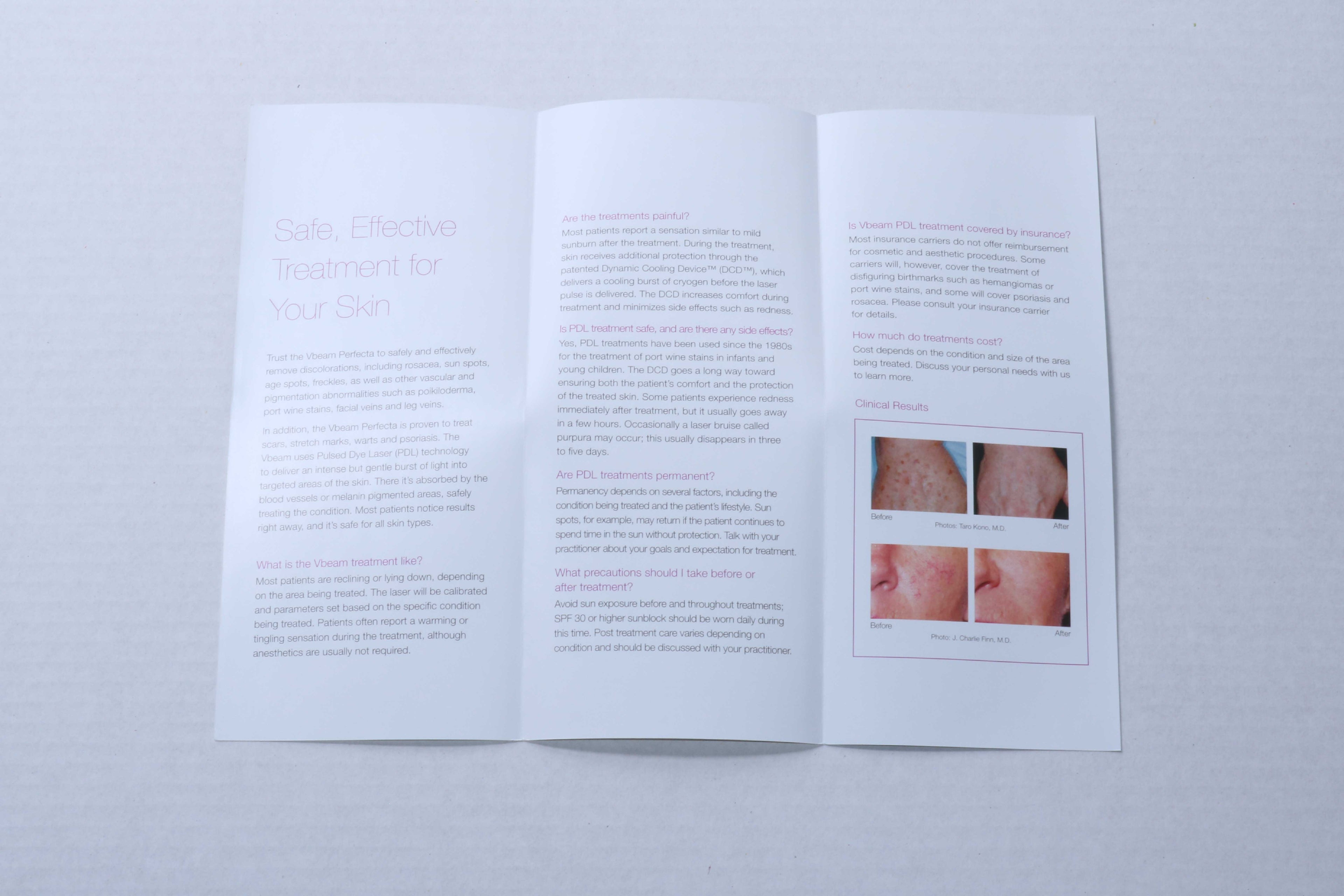 2012 Candela Vbeam Perfecta Pulsed Dye Laser Vein/Pigment Patient Brochures 17pk