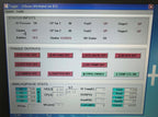 2003 Candela V Beam Pulsed Laser PDL Pulse VBeam Vascular Scar Veins NEW DYE KIT