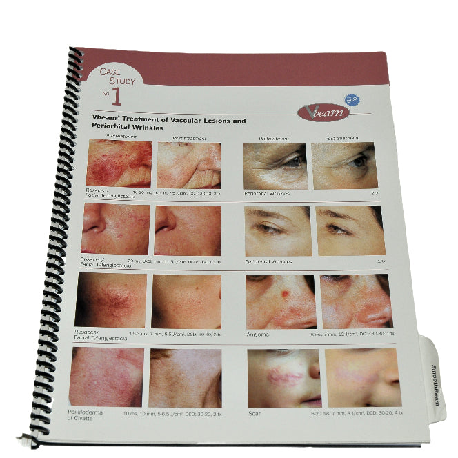 Candela Laser Training GentleLase SmoothBeam GentleYAG VBeam Reference Manual
