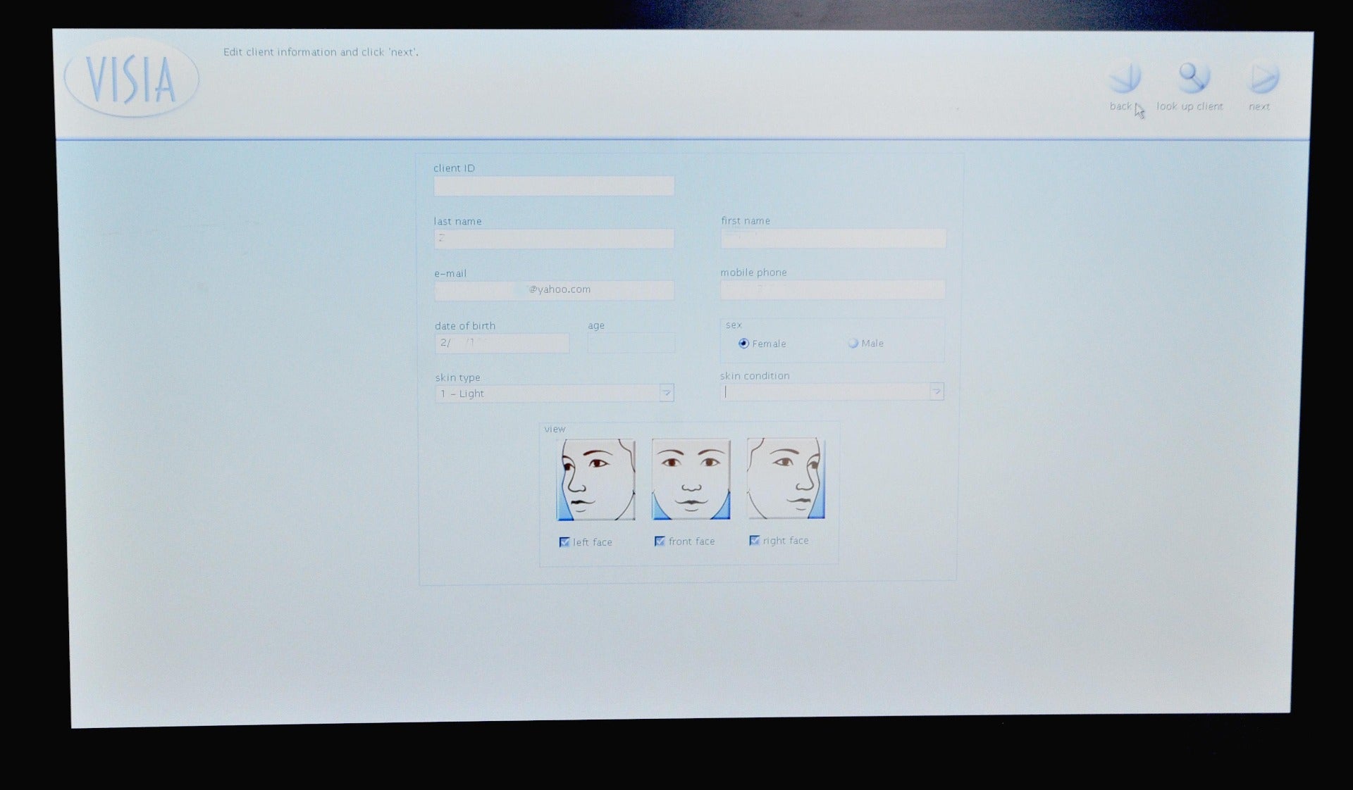 Canfield Scientific Visia Imaging Patient Photos Image Skin Care Analysis System