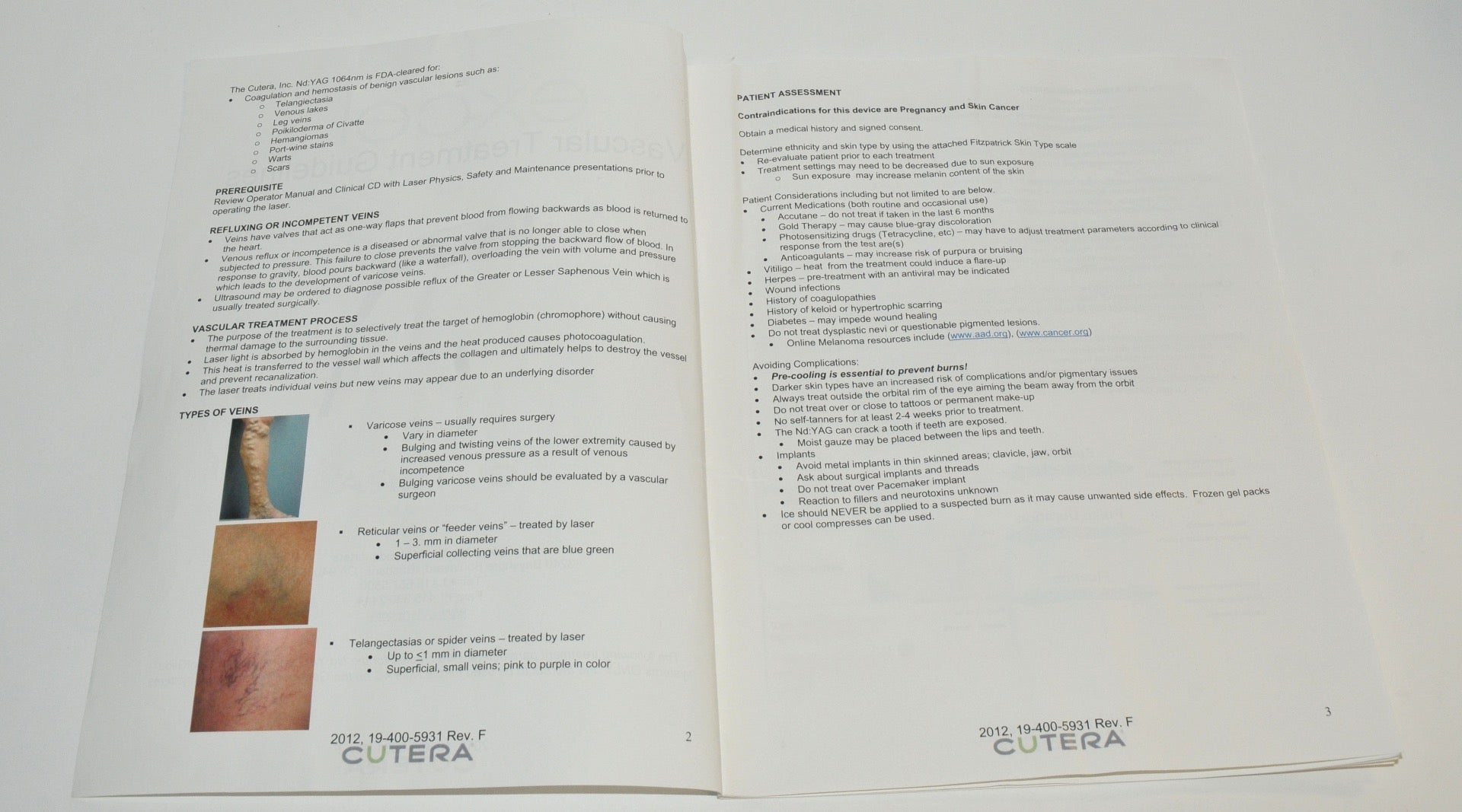 Cutera Excel Laser Vascular Treatment Guidelines 19-400-5931 Rev. F