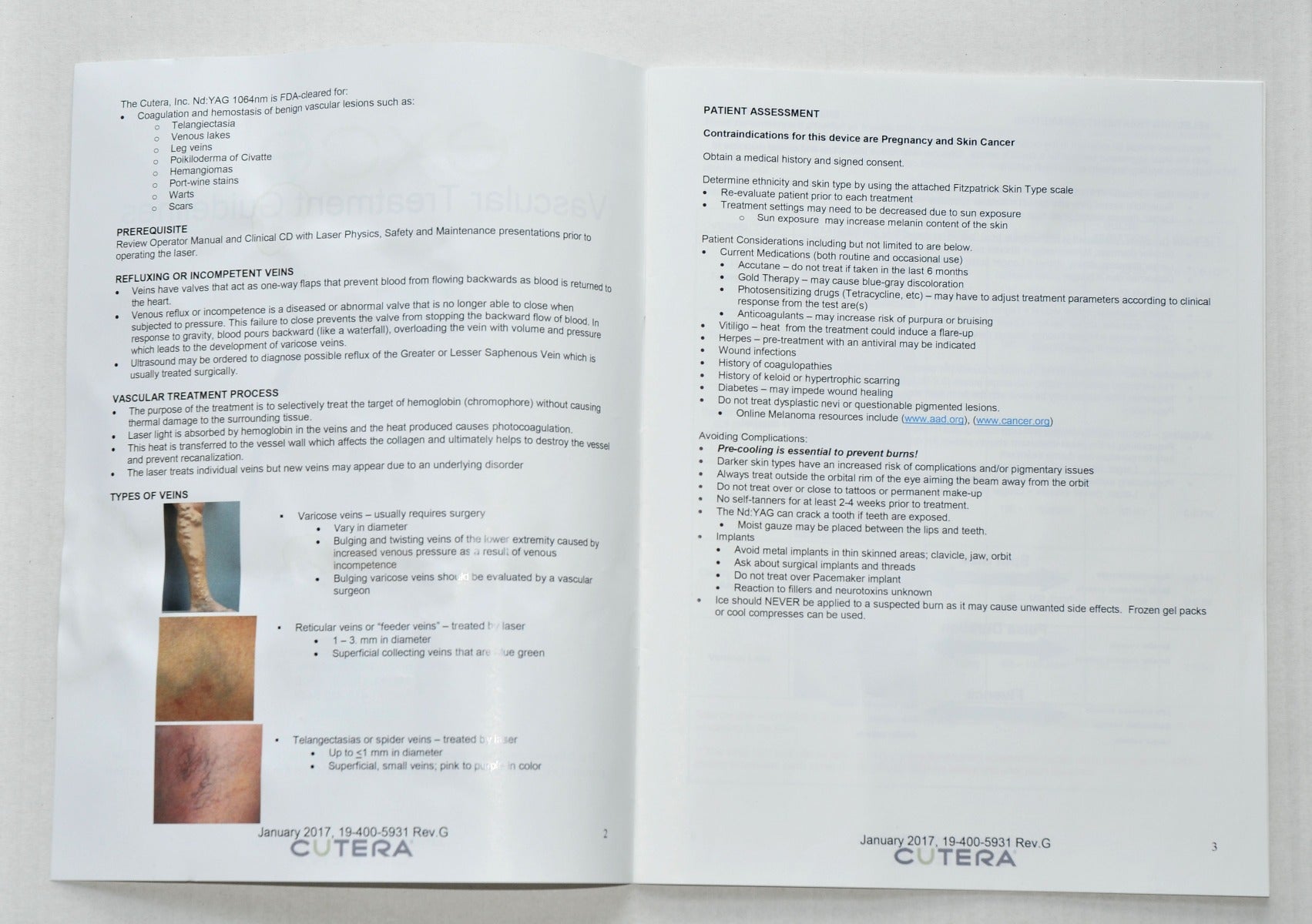 Cutera Excel Laser Vascular Treatment Guidelines Parameter Settings 19-400-5931