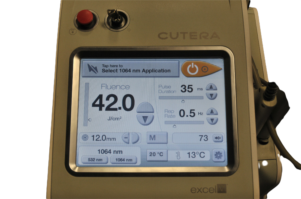 Cutera Excel V Laser 532 1064 Nd YAG Vascular Genesis XLV NdYAG ExcelV XL V 2016