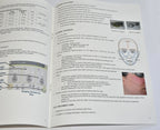 Cutera Laser Genesis Treatment Guidelines Parameter Settings Booklet D0028 2013