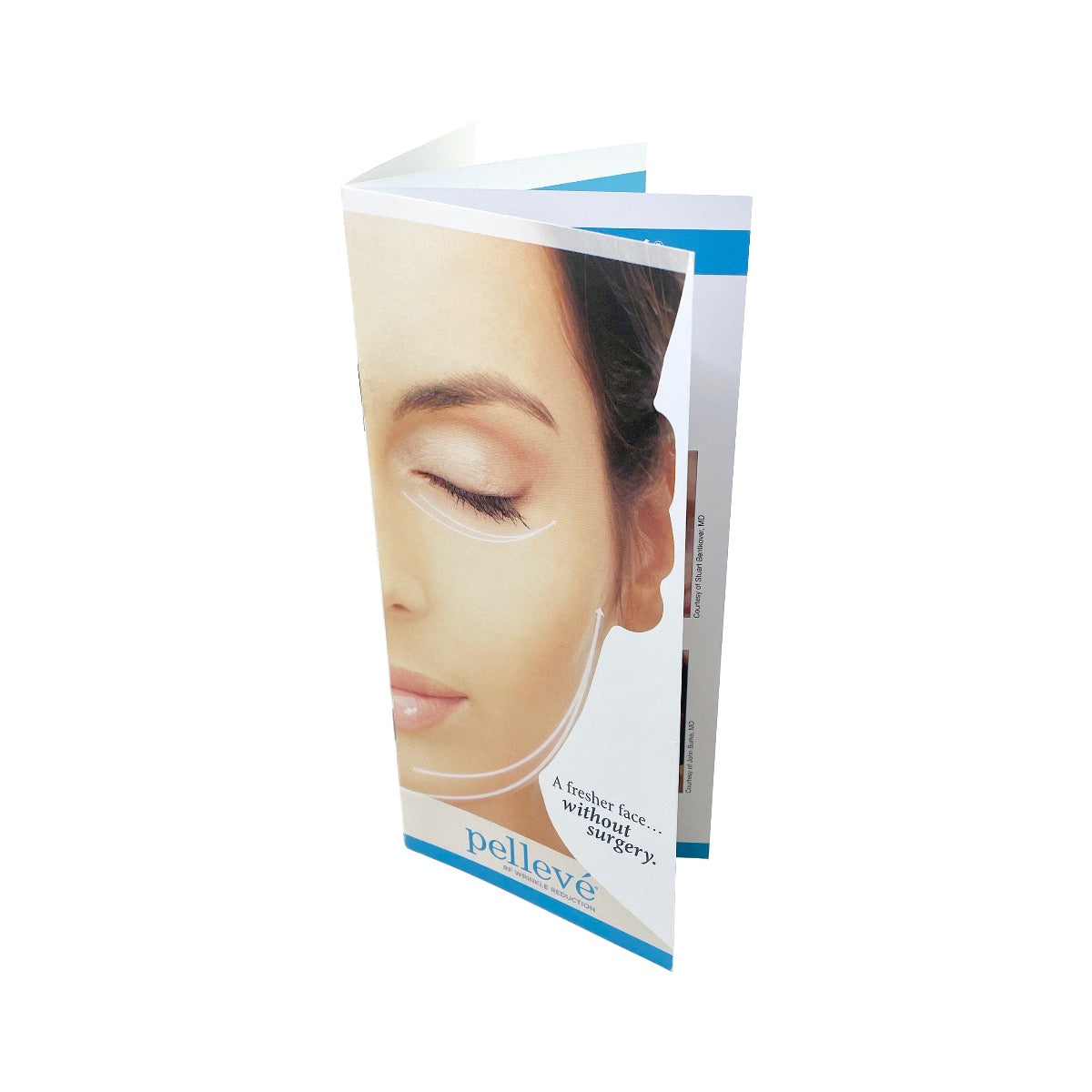 Cynosure Ellman Pellevé RF Wrinkle Reduction Brochures CC09107Y - 30 Pack