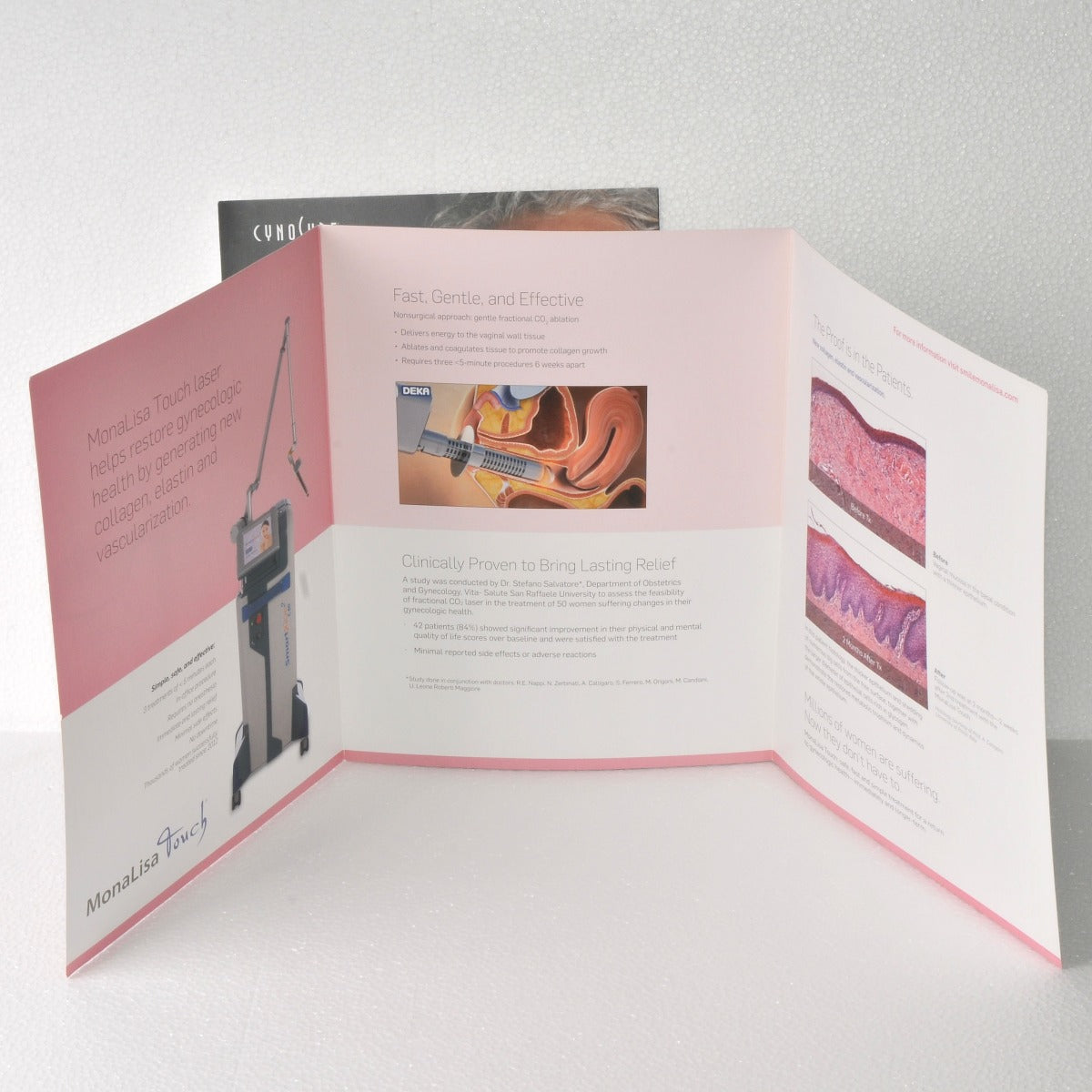 Cynosure MonaLisa Touch Tri-Fold Office Patient Brochure MONA LISA Vaginal Care