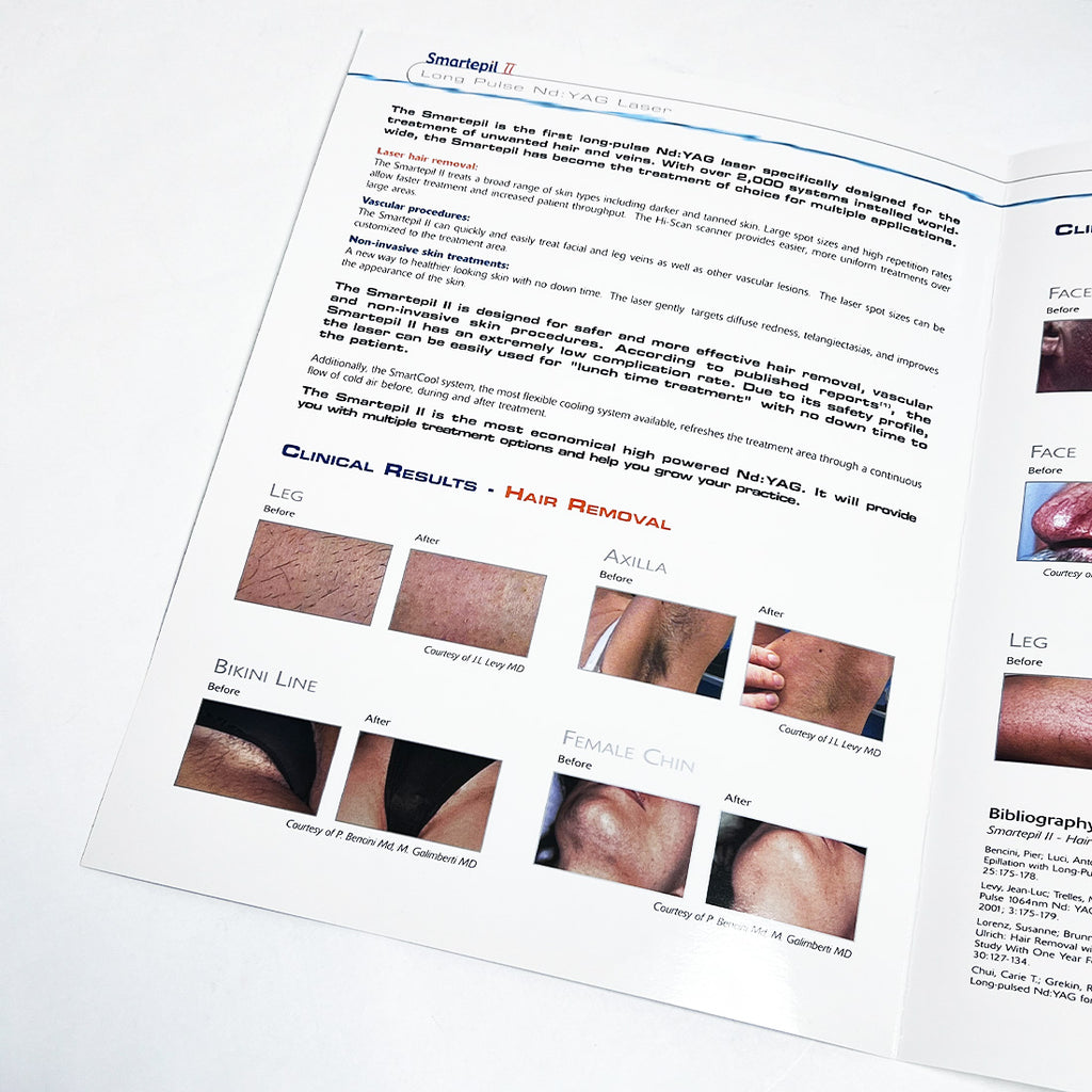 Cynosure SMARTEPIL II Long Pulse Nd YAG Laser Marketing Booklet 920-0175-000