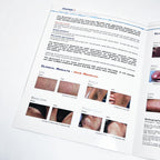 Cynosure SMARTEPIL II Long Pulse Nd YAG Laser Marketing Booklet 920-0175-000