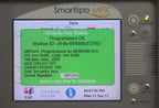2008 Cynosure SmartLipo MPX 20W Nd YAG Laser 1064 nm Facial Leg NO RFID REQUIRED