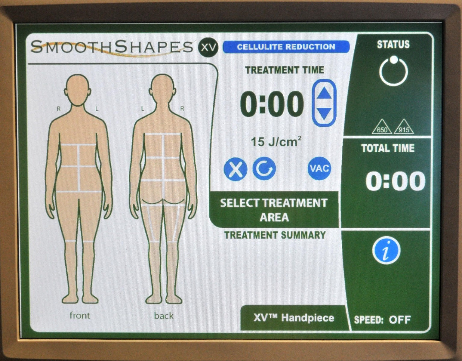 Cynosure Eleme SmoothShapes XV Cellulite Reduction Body Contouring Laser System