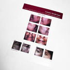 Cynosure The Crown Jewels Vascular Lasers Marketing Booklet 920-0138-000