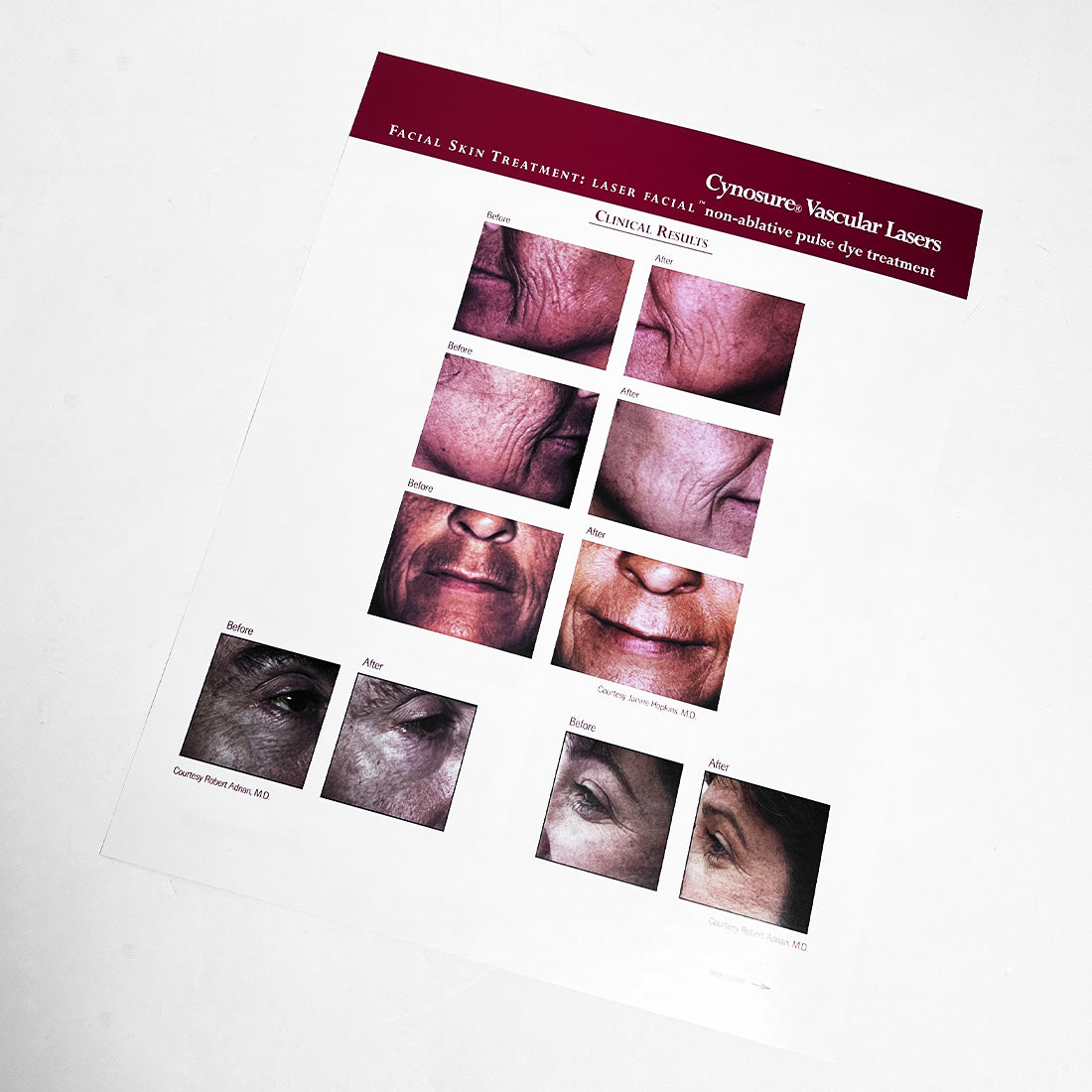 Cynosure The Crown Jewels Vascular Lasers Marketing Booklet 920-0138-000