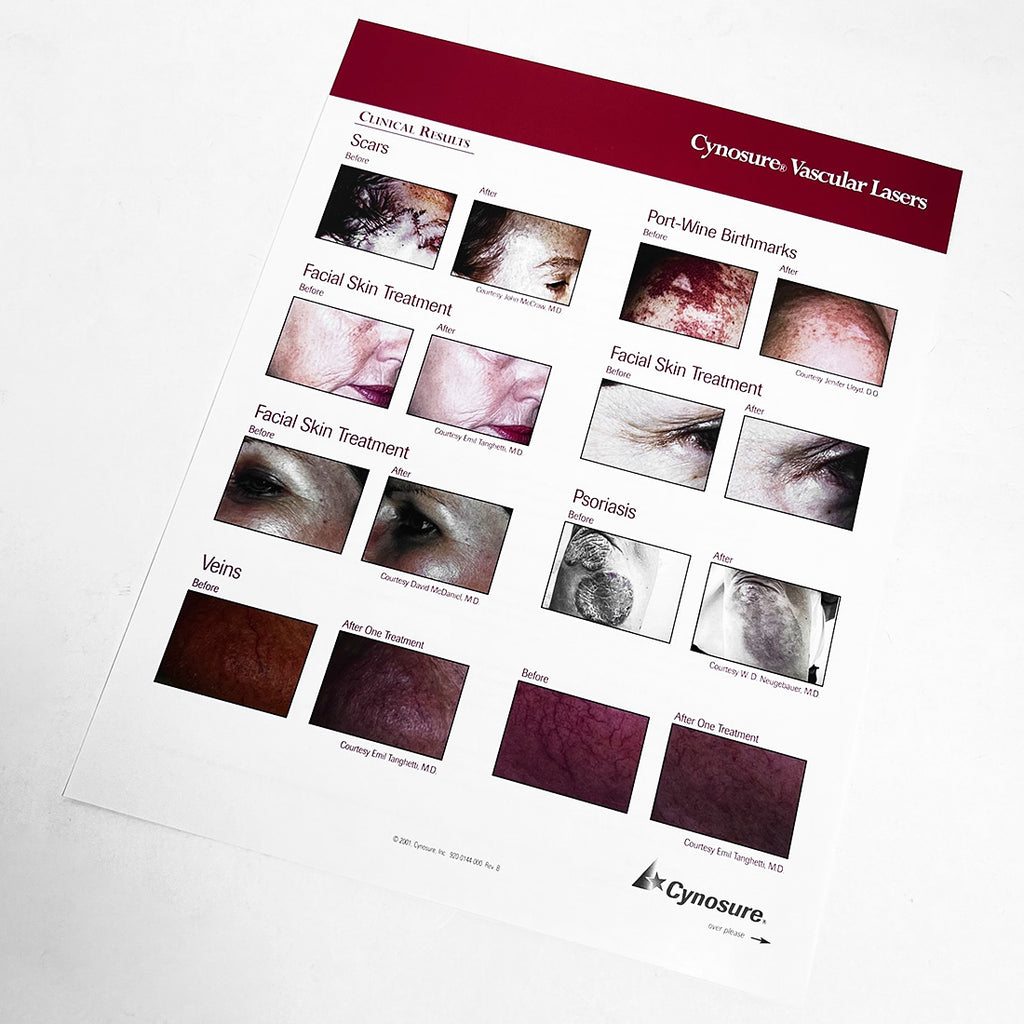 Cynosure The Crown Jewels Vascular Lasers Marketing Booklet 920-0138-000