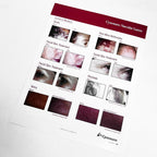 Cynosure The Crown Jewels Vascular Lasers Marketing Booklet 920-0138-000