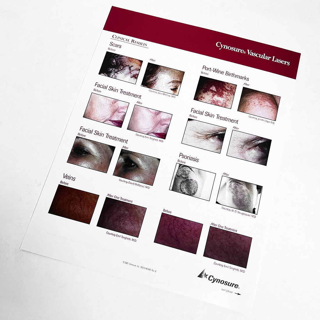 Cynosure The Crown Jewels Vascular Lasers Marketing Booklet 920-0138-000