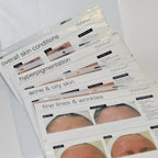 Edge Systems Hydrafacial Before & After Picture Book Patient Marketing 19213-B