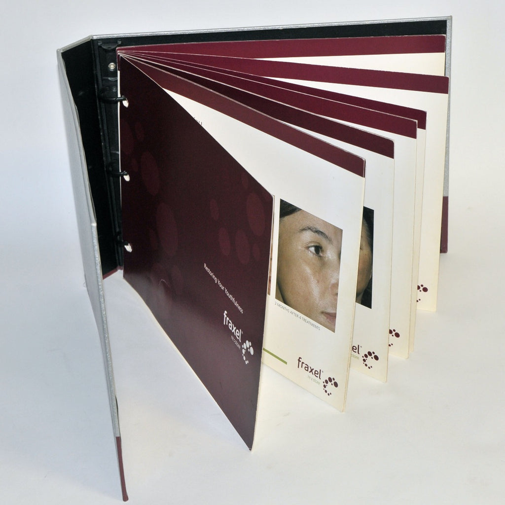 Reliant Technologies Fraxel Re:Store Laser Patient Before After Photos Brochure