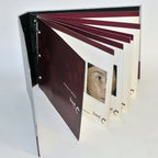 Reliant Technologies Fraxel Re:Store Laser Patient Before After Photos Brochure