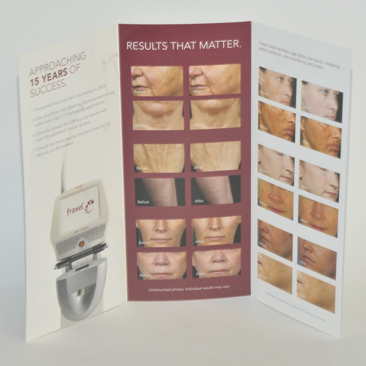 Reliant Technologies Fraxel Re:Store Laser Patient Brochure Skin Treatment Qty35
