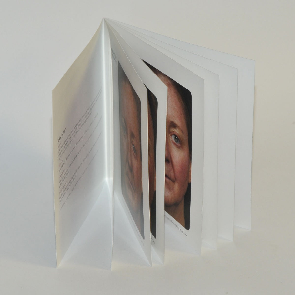 Reliant Technologies Fraxel Re:Store Laser Patient Diary Office Brochure x32 Pcs