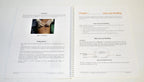Cynosure Smartlipo Cellulaze Clinical Reference Manual User Guide 921-7014-002