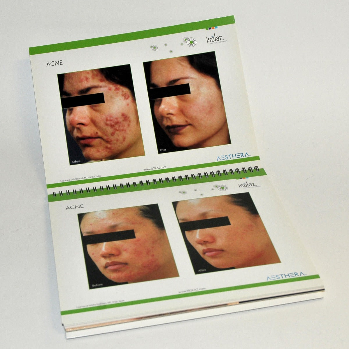 Aesthera Isolaz LASER Office Marketing Consulting Before After Brochure Book