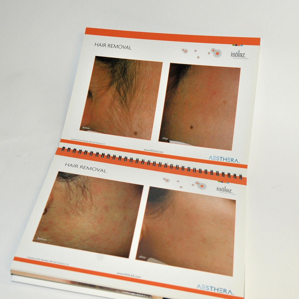 Aesthera Isolaz LASER Office Marketing Consulting Before After Brochure Book