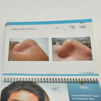 Aesthera Isolaz LASER Office Marketing Consulting Before After Brochure Book